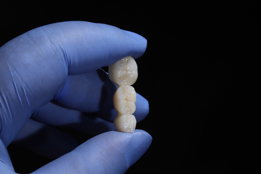 how much does a dental crown cost in conroe