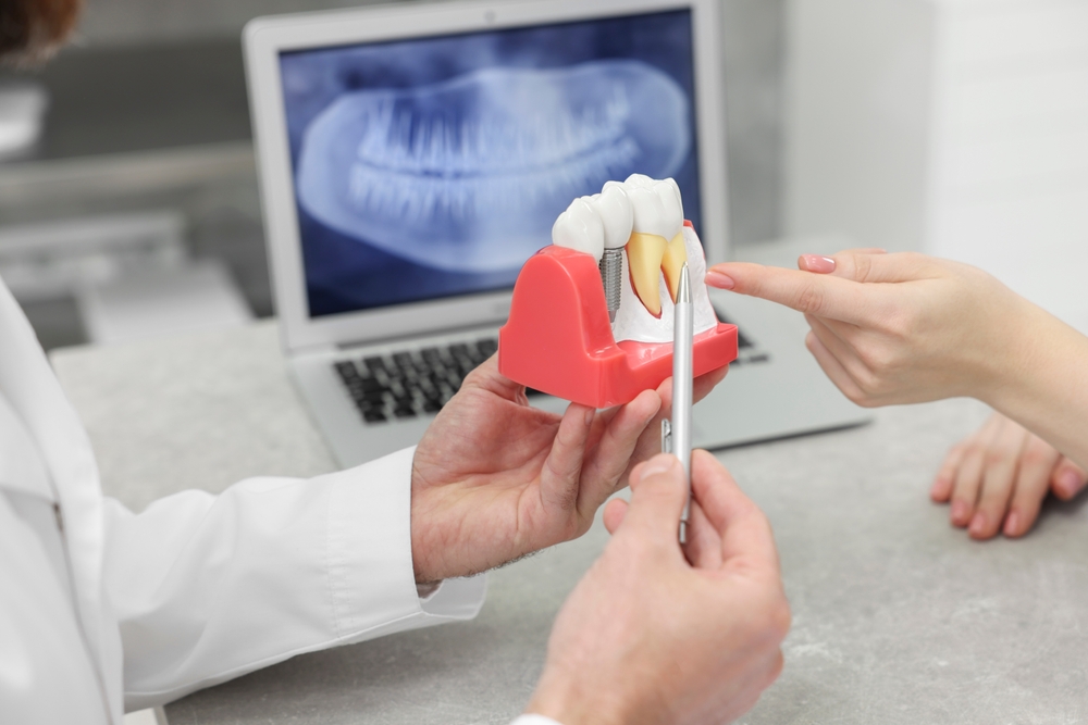 what s the real timeline for getting a dental implant start to finish